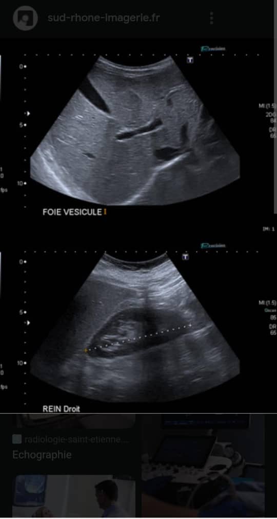 Image pour Gynécologie